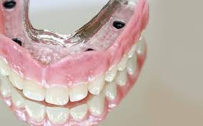 Image result for dentures