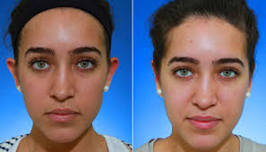 ‫راه های روشن و سفید شدن پوست صورت و بدن‬‎