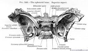 The sphenoid bone, also known as os sphenoidale, is a cranial bone, shaped like a butterfly or a wasp, which occupies most of the middle part of the skull's base, making up the middle region of the cranial fossa. Sphenoid Bone Prohealthsys