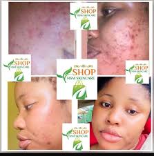 Joy Chinwenmeri Onwubuariri is currently