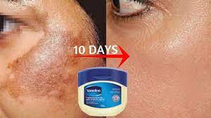 Take a further 10% student discount off our already amazing prices! Vaseline To Remove Skin Pigmentation Dark Spots In Just 10 Days 100 Effective Home Remedy Youtube