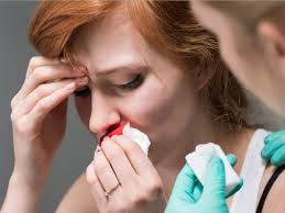 Đau đầu chảy máu cam cảnh báo bệnh lý nguy hiểm nào?