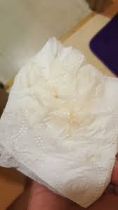 With some questions, a pelvic exam, and in some cases imaging or additional tests, your obstetric care professional should be able to determine what's at the root of your irregular bleeding and provide a treatment plan.4 Sorry Tmi Pic Ovulation Spotting Trying To Conceive Forums What To Expect