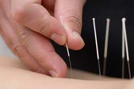 Relieving Pain With Acupuncture Harvard Health