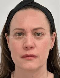 Cosmetic Dermatology & Medical Aesthetic clinic in Laval