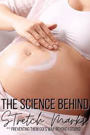 How To Avoid Stretch Marks During Pregnancy - Swaddles N' Bottles