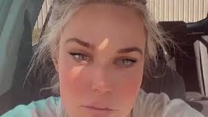 CJ Perry Is Back In The Hospital Due To Complications; May Need Second  Surgery On Finger