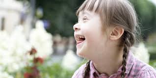 Honnan ered a „down elnevezés? Szimpatika Ma Van A Down Szindroma Vilagnapja