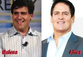 What's the best advice you've ever received? Mark Cuban Plastic Surgery Is It A Flip Or A Flop