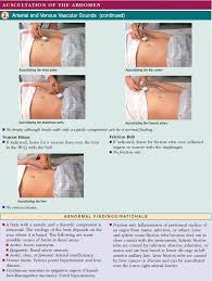 Pin By Dani Reedy On Nursing Abdominal Aorta Arteries Vascular