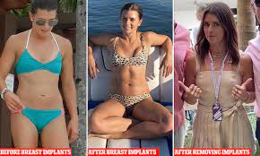 NASCAR racer Danica Patrick had breast implants removed after they caused  hair loss, metal toxicity | Daily Mail Online