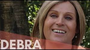 Debra Before and After FFS Surgery — Facialteam