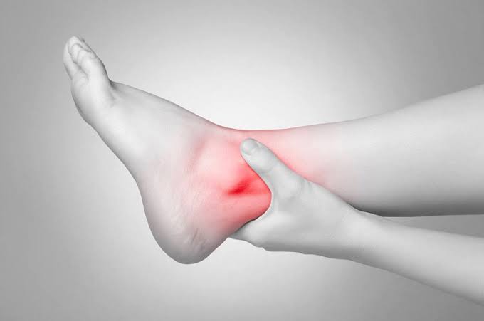 Sưng mắt cá chân nhưng không đau: Nguyên nhân và cách xử lý hiệu quả