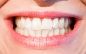Having healthy teeth that look and feel clean and sparkling can help with a number of facets of your life. Teeth Whitening Home Remedies What You Should Know Utopia
