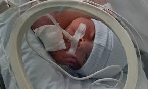 Julián, el bebé bahiense operado por una malformación, dejó la terapia  intensiva: Sigue internado en Mar del Plata. La emoción de los padres de  poder tenerlo en brazos.