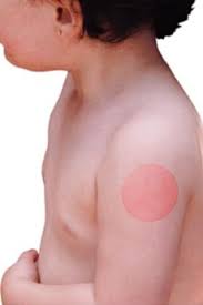 La masse musculaire réagit l'enveloppe graisseuse qui entoure cette protéine serait à l'origine de la douleur que nous. Diminuer La Douleur Et L Anxiete Liees A La Vaccination Chez Les Enfants Gouvernement Du Quebec