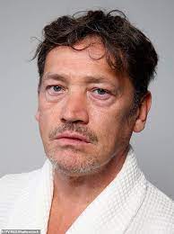 He died on october 2, 1985 in los angeles, california, usa. Eastenders Sid Owen Unveils Aftermath Of Accident Which Shattered His Jaw And Knocked Out Six Teeth Daily Mail Online