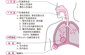 Check spelling or type a new query. è‚ºç‚Žã«é–¢ã™ã‚‹q A çœ‹è­·roo ã‚«ãƒ³ã‚´ãƒ«ãƒ¼