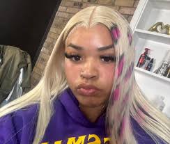 SCALP BABY 🙂‍↕️🩷 https://TheLaceeDoctor.as.me/ February Bookings Are Open  As well $100 Installs Feb. 1-15th Take Advantage NOW ☺️🥳