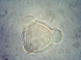 Image result for Millettia eetveldeana