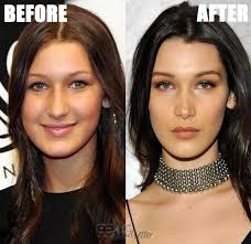 Save up money and go to taban instead of these weirdo turkish docs. Bella Hadid Plastic Surgery Secrets Exposed 2020