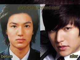 Senin, 24 agustus 2020 menjadi salah satu aktris favorit dan cantik. Lee Min Ho Dan 4 Artis Korea Operasi Plastik