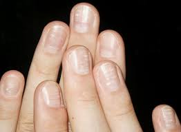 Image result for à¤à¥à¤²à¥à¤¶à¤¿à¤¯à¤® à¤à¥ à¤à¤®à¥