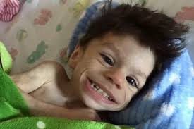 Amazing pictures show transformation of orphan, seven, who weighed just 8lb  when he was saved by new family