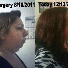 DALE E STRINGER, DDS