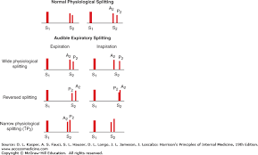 Approach To The Patient With A Heart Murmur Harrisons