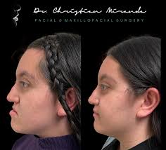 Photos by 🇲🇽Dr. Christian Miranda Lozada (@dr_christian_milo_) · August  21, 2025