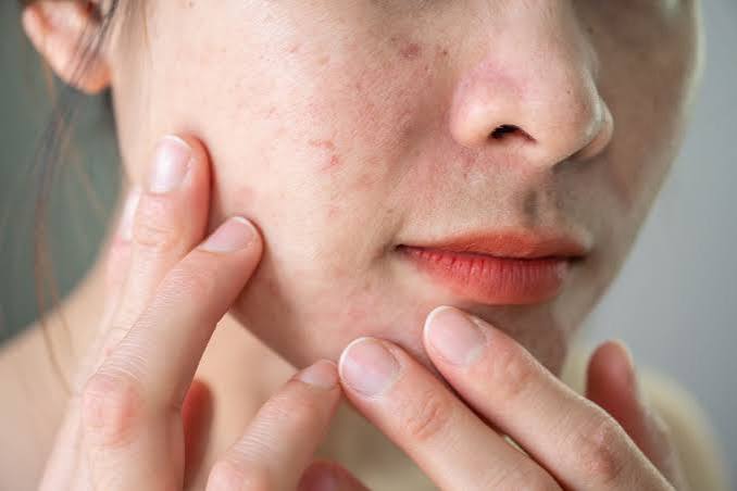8 Treatments That Can Improve Your Skin Texture, According to Dermatologists