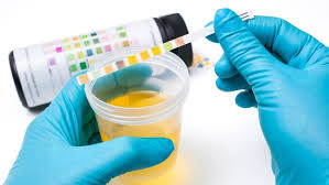 Ibu hamil dapat mengonsumsi lebih banyak makanan yang mengandung tinggi zat besi seperti sayuran hijau, daging merah, telur, dan. Arti Protein Urine Positif 1 Pada Ibu Hamil