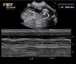 using ultrasound to evaluate the canine pregnancy