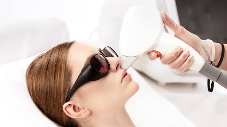 Image result for laser hair removal"
