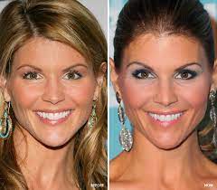 Hollywood S Best Botox Newbeauty Botox Natural Botox Botox Before And After