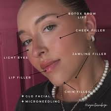 ✨The Power of Injectables & Skincare✨ I've had the absolutely honor of  caring for the stunning @mmadisonggilbert over the years. I'm also so  thankful that she's never kept what she's had done