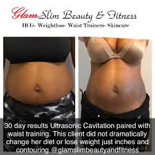 Ultrasonic cavitation machines utilizes a focused wave transmitter to project the high frequency sound waves with a frequency of up to 40khz (40,000 vibrations per second). Ultrasonic Cavitation And Glamslim Beauty And Fitness Facebook