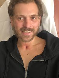 Player injured, wearing neck brace