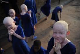 Tanzania has a high fertility rate of 4.8 births per woman and a high birth rate of 36.2 births per 1,000 people. Albino Persecution Must Stop We Are People Too