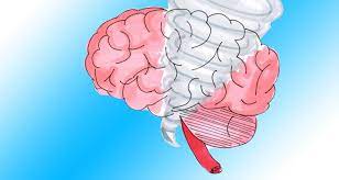 Malignes Neuroleptisches Vs Serotonin Syndrom