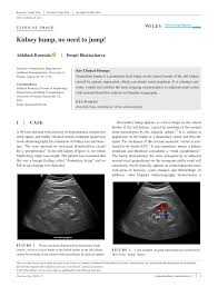 3 it can sometimes mimic a kidney neoplasm and therefore considered a renal. Pdf Kidney Hump No Need To Jump