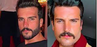 وتتميز هذه العملية بنتائجها الدائمة التي توفر على النساء الإزالة المتكررة للشعر الزائد. Ù…Ù‡Ù†Ø¯ Ø§Ù„Ø­Ù…Ø¯ÙŠ ÙŠØµØ¯Ù… Ø§Ù„Ø¬Ù…Ù‡ÙˆØ± Ø¨ØµÙˆØ±Ù‡ Ø¨Ø¹Ø¯ Ø¹Ù…Ù„ÙŠØ§Øª Ø§Ù„ØªØ¬Ù…ÙŠÙ„ Beirutcom Net