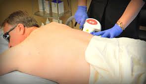 Laser hair removal is among the most commonly performed cosmetic procedures in the u.s. Atlanta Laser Hair Removal For Men Treatments Procedures Recovery