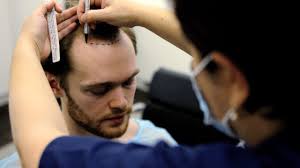 Hair transplant clinic Dubai | Harley Street Hair Clinic