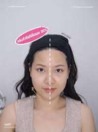 เครื่องยกกระชับ Thermalift: ความงามที่เห็นผลทันที