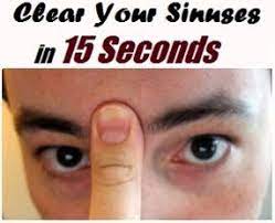 Clear Your Sinuses In 15 Seconds By Pressing Ourfamilyhealth Sinusitis Sinus Remedies Remedies