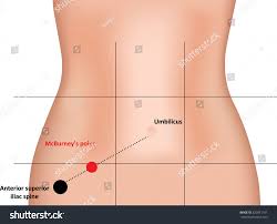 Image Result For Mcburney Point Body Anatomy Nclex Gastrointestinal