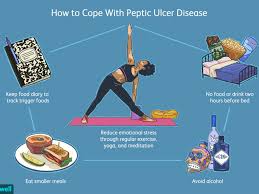 How does science define mouth ulcers? Peptic Ulcers Coping Support And Living Well