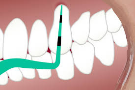Maybe you would like to learn more about one of these? The High Risks Of Ignoring Gum Disease Your Dental Health Resource
